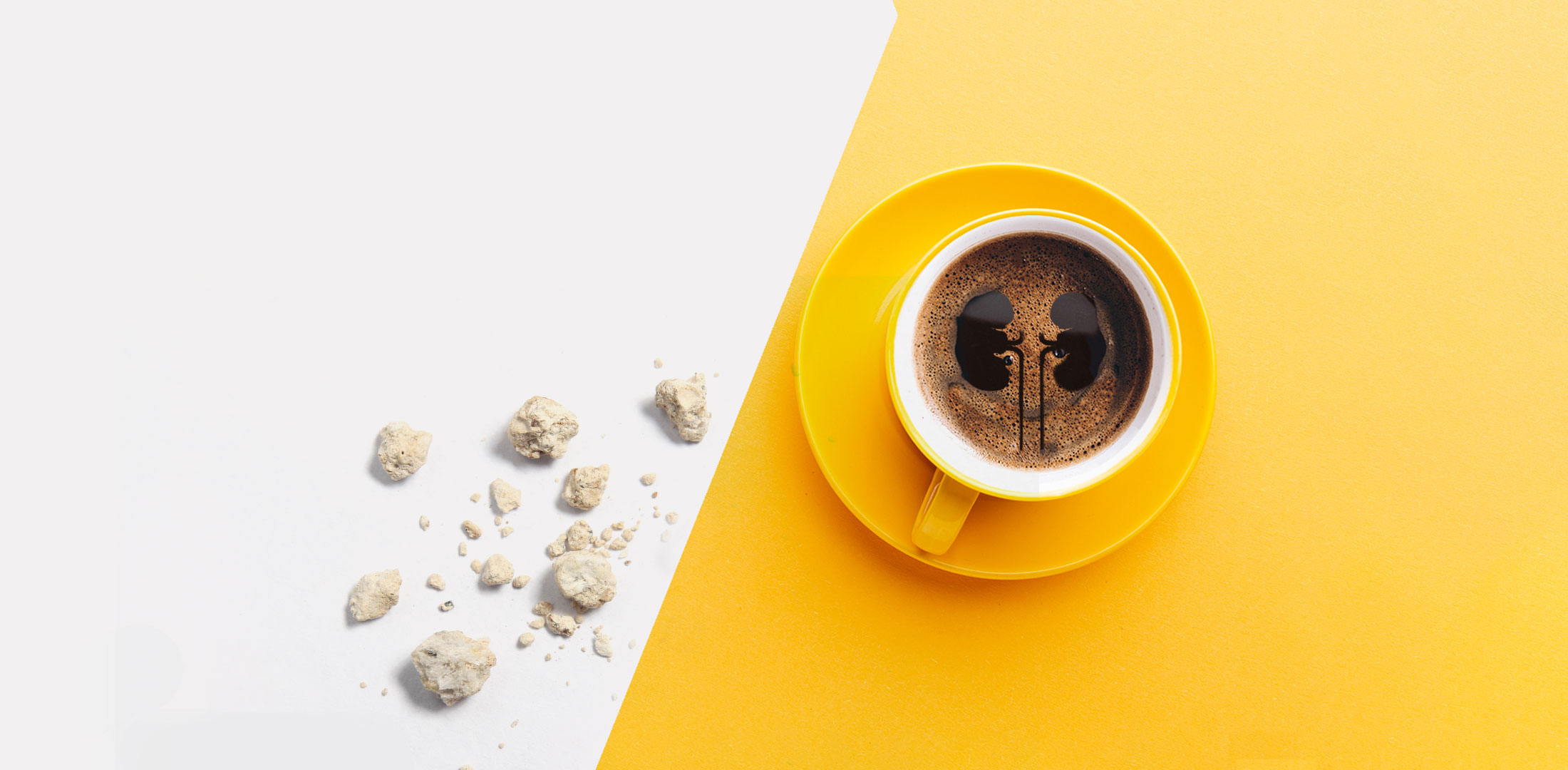 Kahve böbrek taşı yapar mı | bobrek-tasi-holep-uroloji-doktoru-kadir-tepeler-tas-hastalikları
